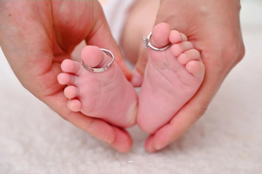 青岛孕妇怎样预防妊娠纹